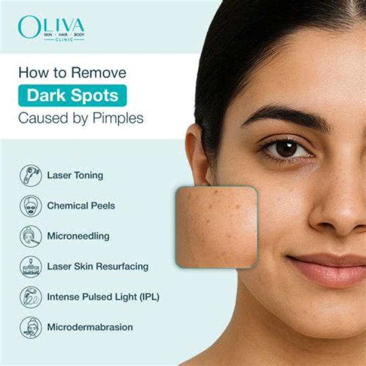 Does Kojivit remove dark spots?