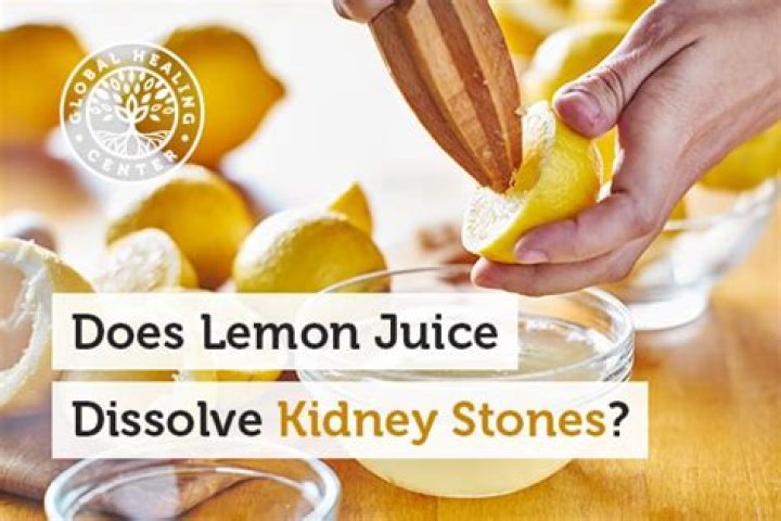 Does lemon juice dissolve stones?