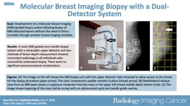 Does Medicare cover molecular breast imaging?