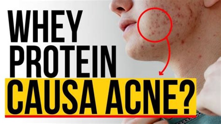 Does protein reduce acne?