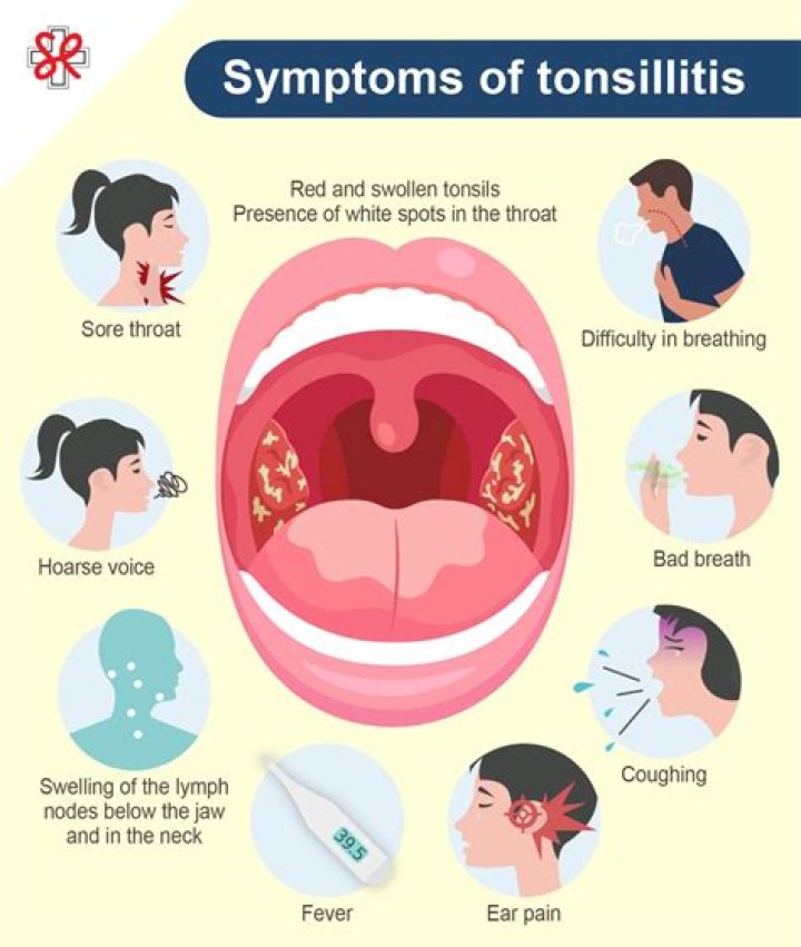 Does pus on tonsils cause bad breath?