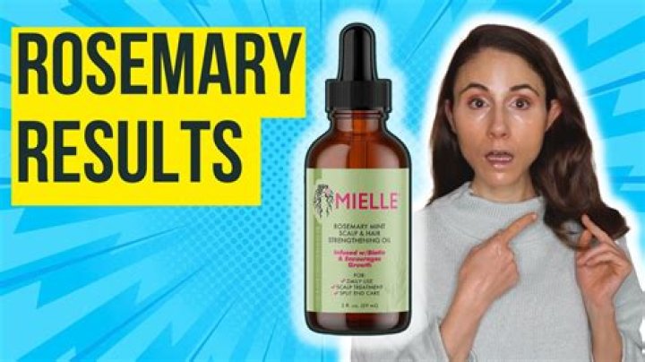 Does rosemary oil help scalp psoriasis?