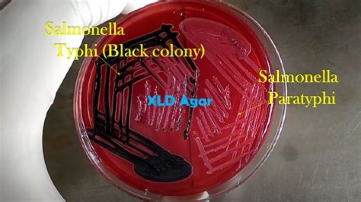 Does Salmonella have Choleraesuis?
