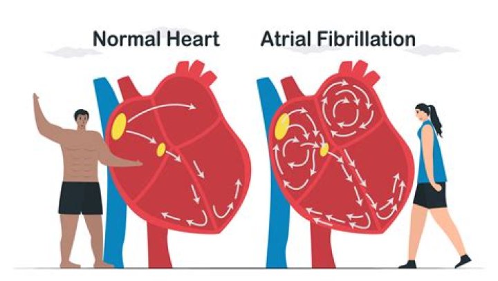 Does shocking the heart cure afib?