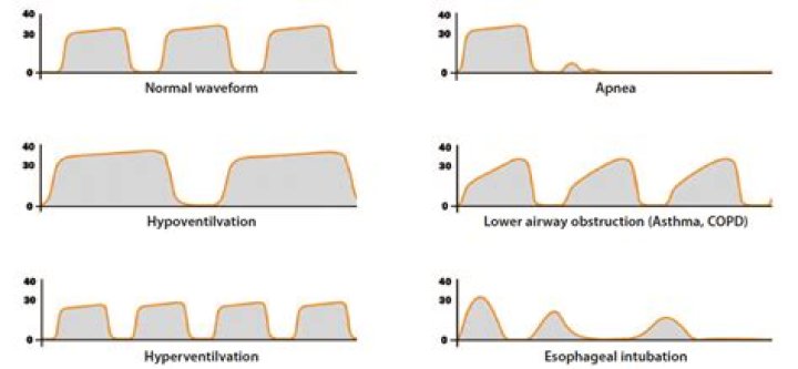 Does tachypnea cause hyperventilation?