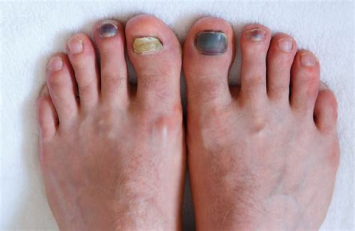 Does toe out help with turn in?