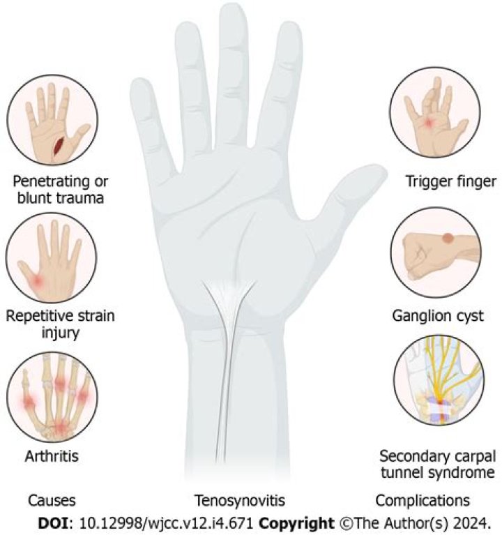 Does transient synovitis go away?