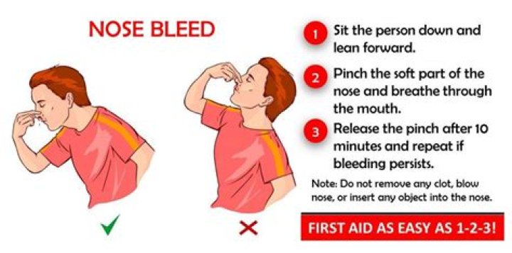 How can I stop my nose from itching?
