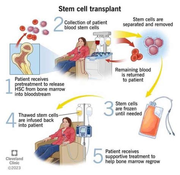 How can stem cells be used to treat heart disease?