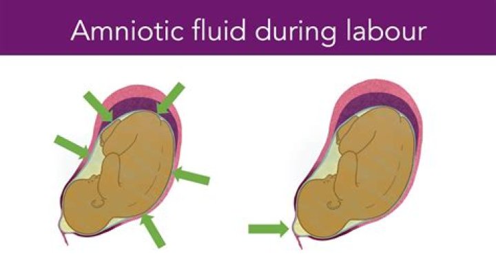 How can you tell the difference between leaking amniotic fluid and discharge?