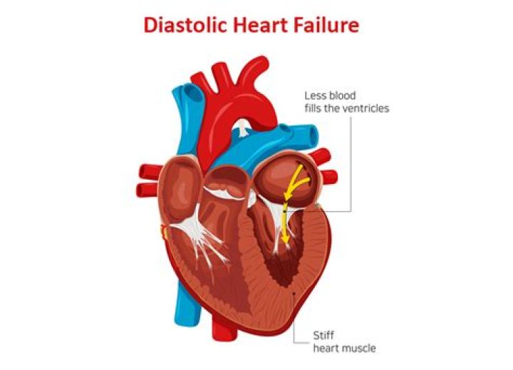 How can you tell the difference between systolic and diastolic heart failure?