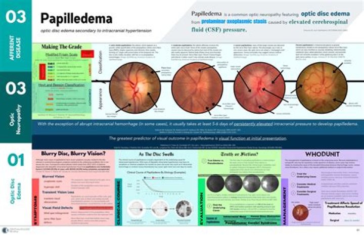 How common is Pseudopapilledema?