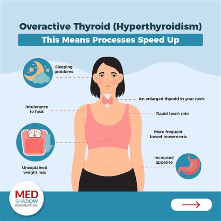 How do I cope with my thyroid?