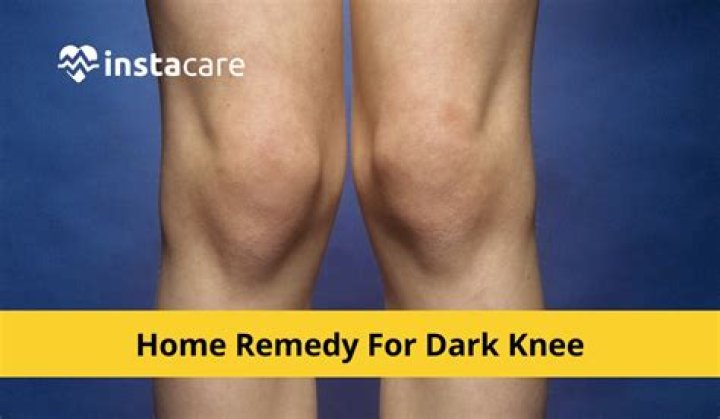 How do I get rid of bumps on my elbows and knees?
