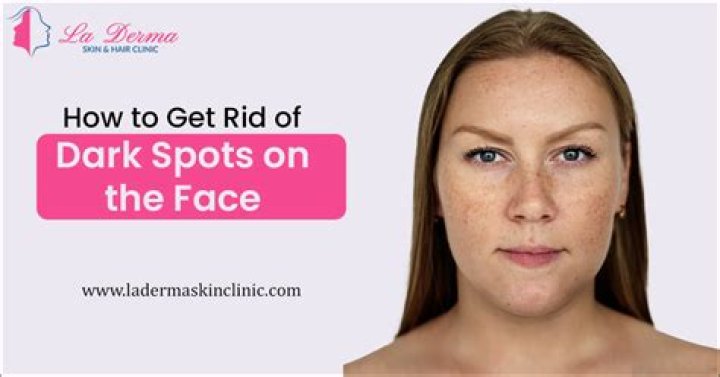 How do I get rid of dark spots around my lips?