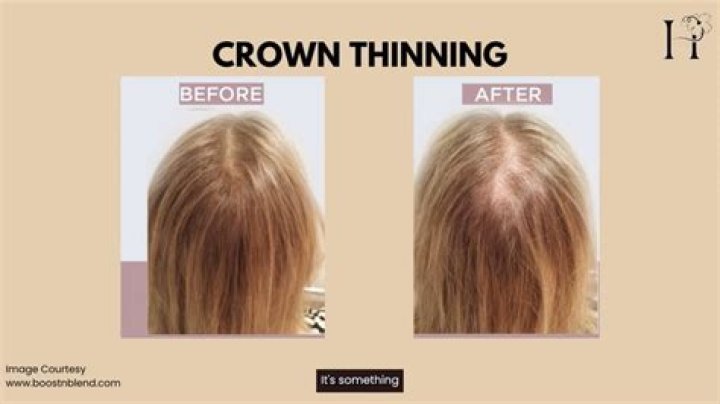 How do I stop my skin from thinning when aging?