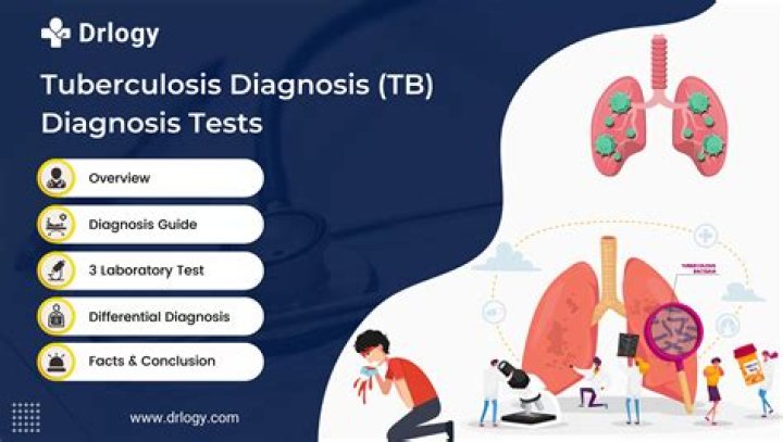 How do rats detect tuberculosis?