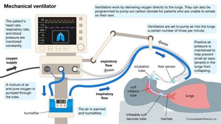 How do you calculate resistance in mechanical ventilation?