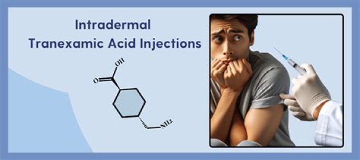 How do you dilute tranexamic acid injections?