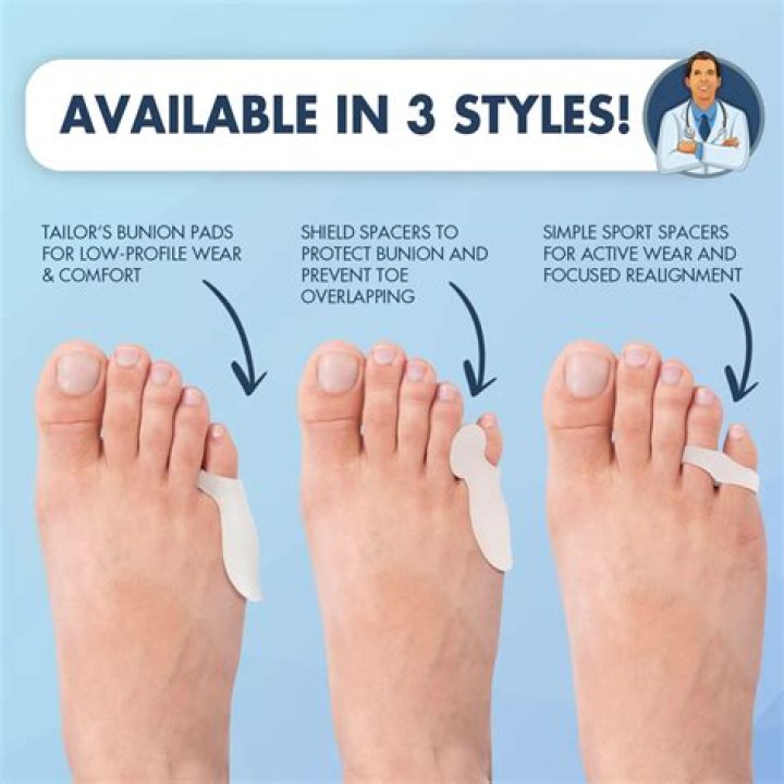 How do you fix bunions UK?