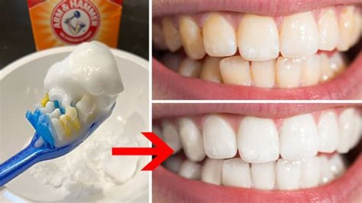 How do you get crystal clear white teeth?