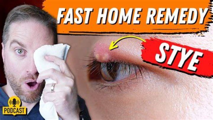 How do you get rid of an eyelash cyst?