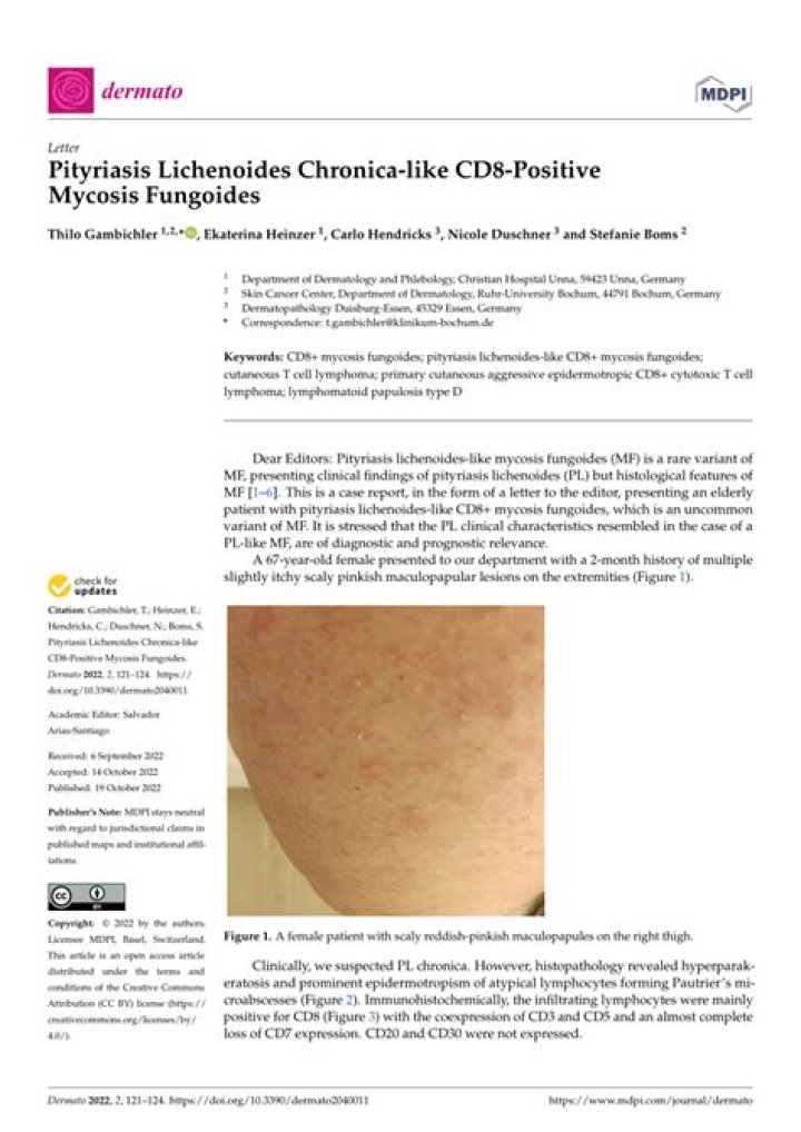 How do you get rid of pityriasis Lichenoides Chronica?