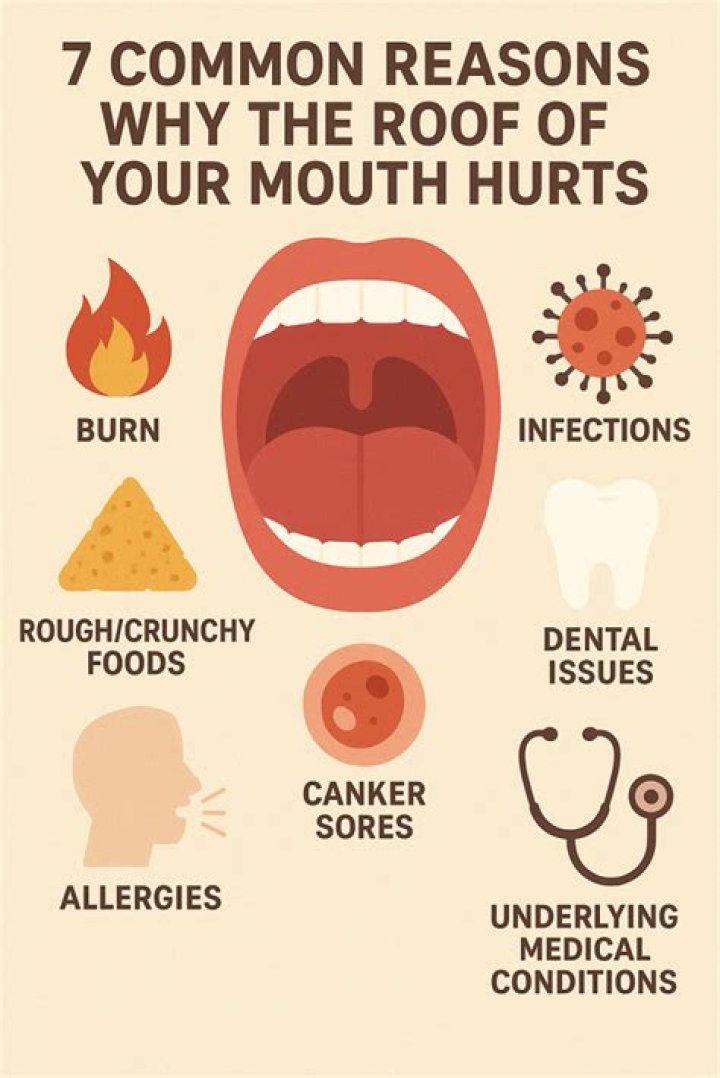 How do you heal the roof of your mouth when you burn it?