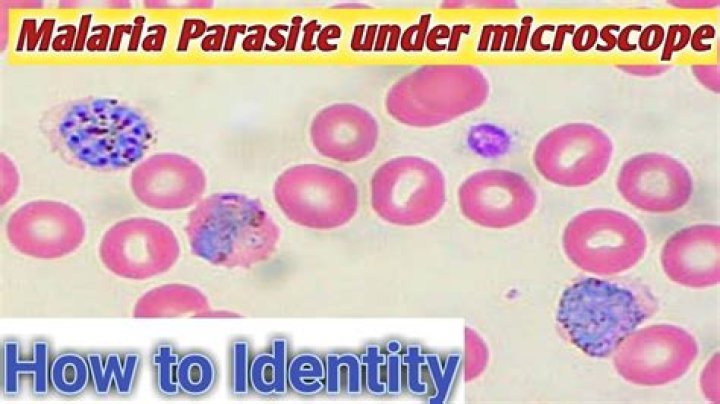 How do you identify malaria parasite under a microscope?