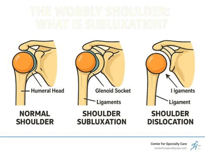 How do you know if your shoulder is popped out of place?