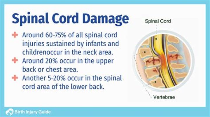 How do you know if your spinal cord is damaged?