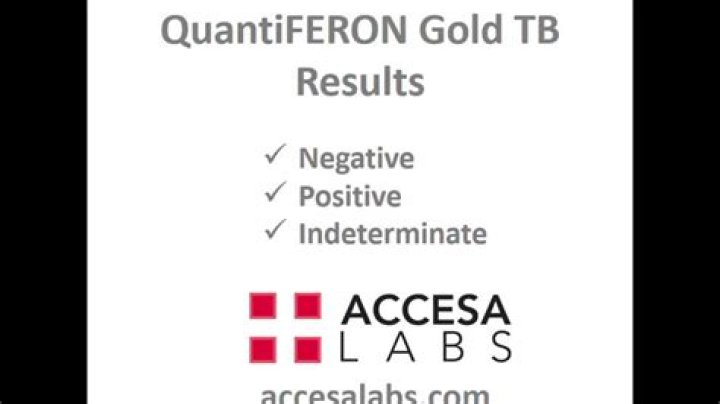How do you read QuantiFERON gold results?