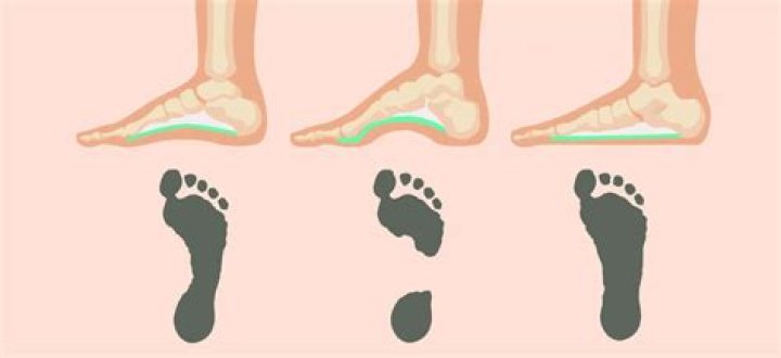 How do you strengthen the arch of your foot?