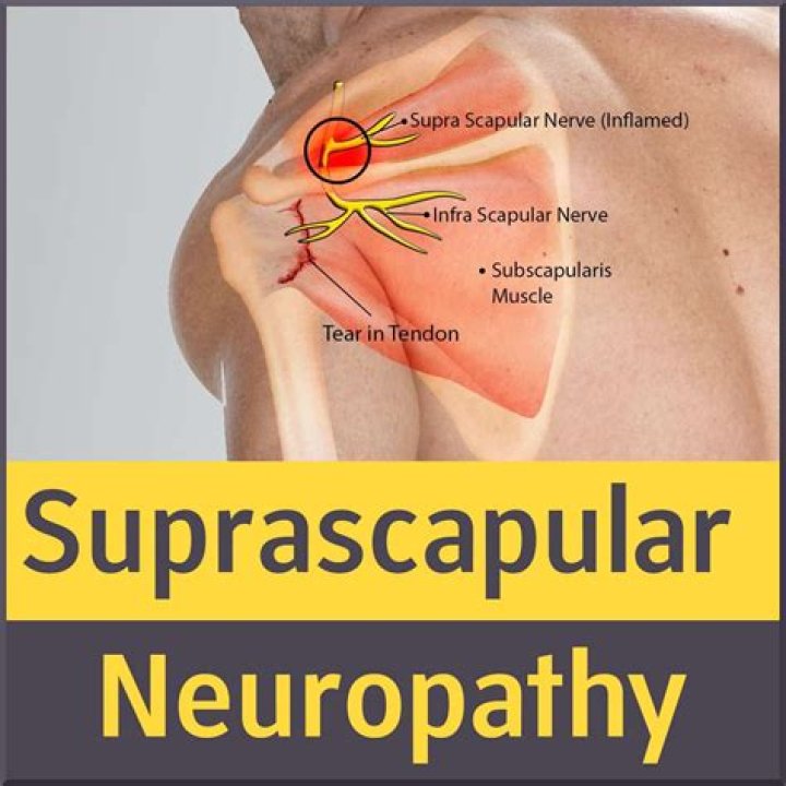 How do you test the suprascapular nerve?