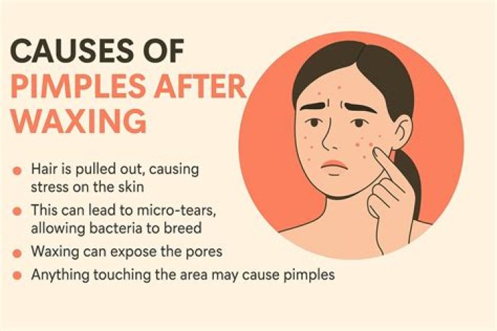 How do you treat chicken skin after waxing?