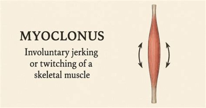 How do you treat middle ear myoclonus?
