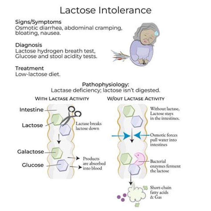 How is a lactose intolerance test done?