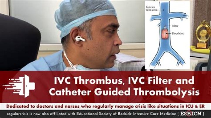 How is IVC thrombus treated?