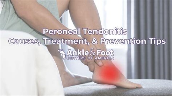 How is peroneal DVT treated?