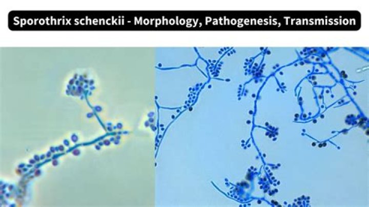 How is Sporothrix schenckii spread?