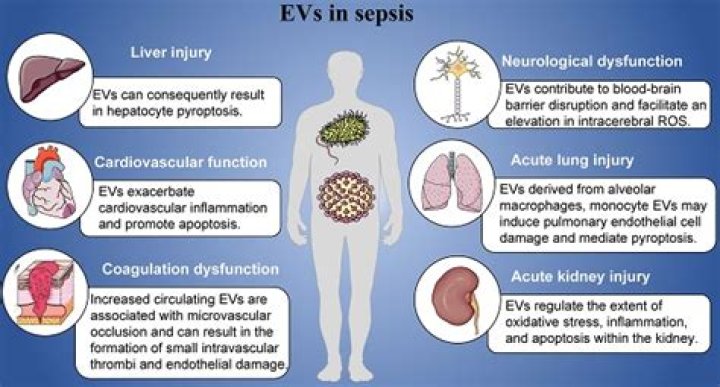 How is the liver affected in sepsis?