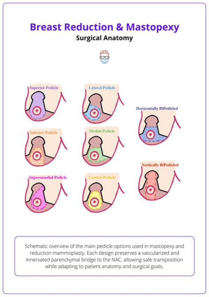 How long are you in pain after a breast reduction?