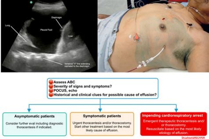 How long can you live with an adrenal tumor?