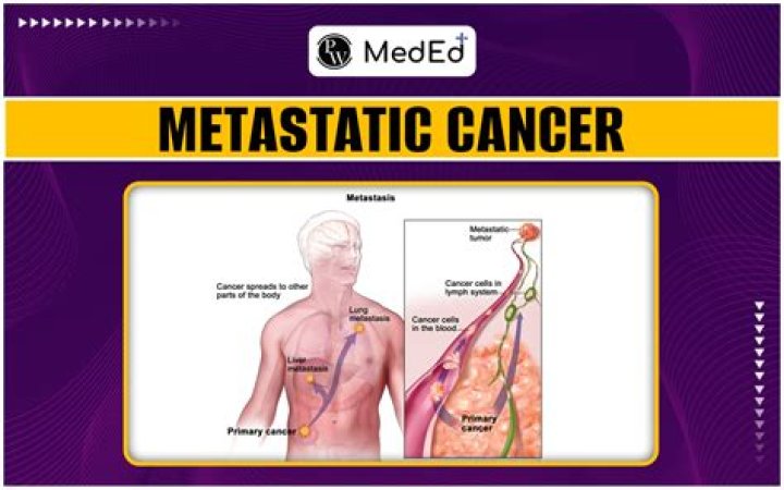 How long can you live with metastatic prostate cancer?