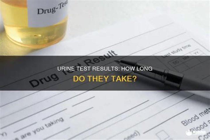How long do urine lab results take?