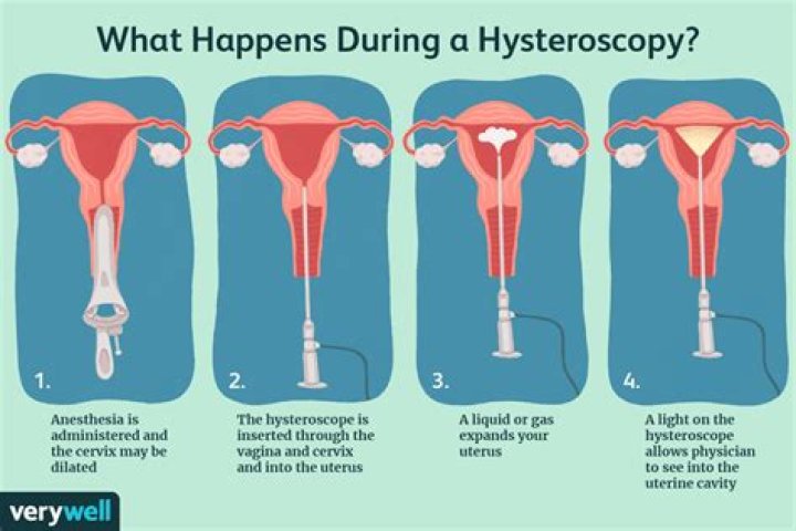 How long do you need off work after a hysteroscopy?