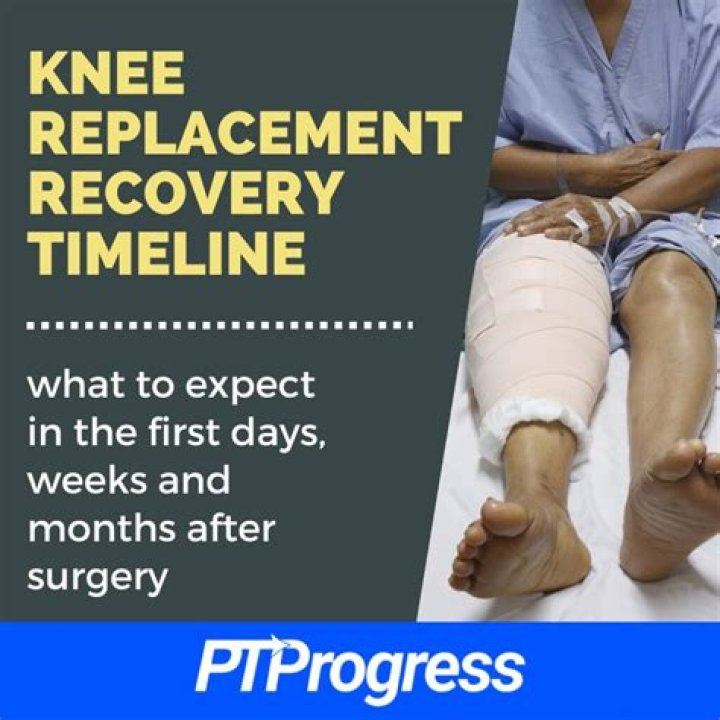 How long does it take to recover from cranioplasty?