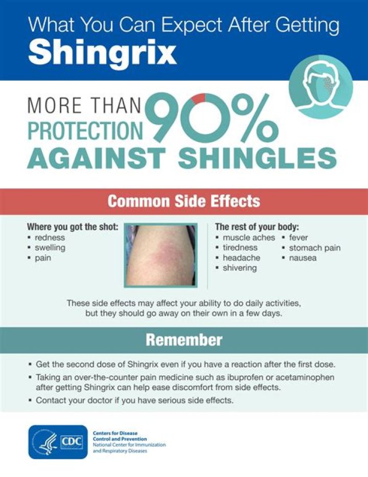 How long does it take to show signs of shingles after being exposed?