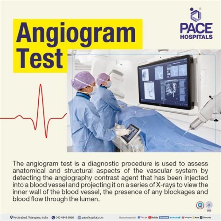 How long does MR angiogram take?