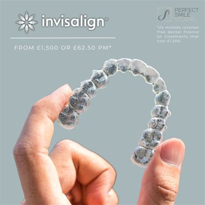 How long is Invisalign Express?